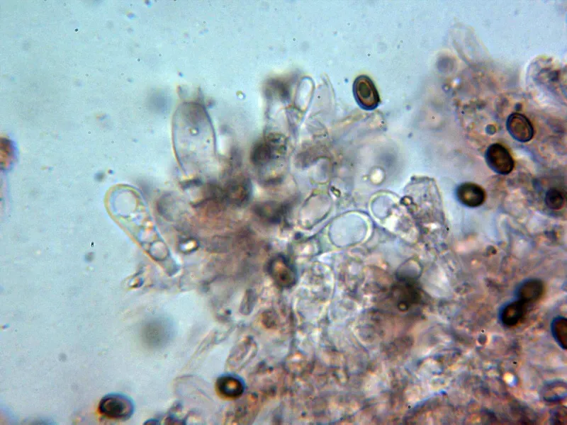 Agaricus comtulus 10 - Arista laminar